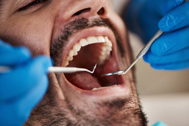 Best Dentist for Severe Toothache  in Heber, UT